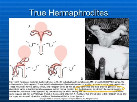 hermaphrodite porm|Hermaphrodite Porn Videos of People with Dicks and Cunts